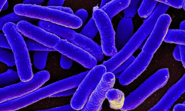 NASA Will Launch E. Coli into Space to Study Antibiotic Resistance